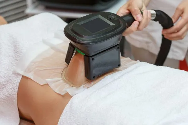 Image of person having fat freezing treatment to help weight gain Bloxwich