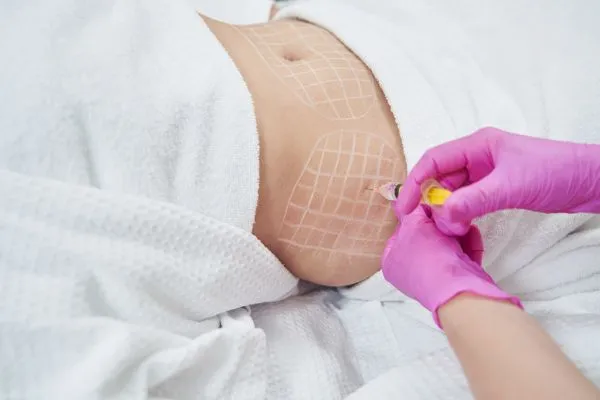 image of fat dissolving injections on love handles to help combat weight gain Bloxwich
