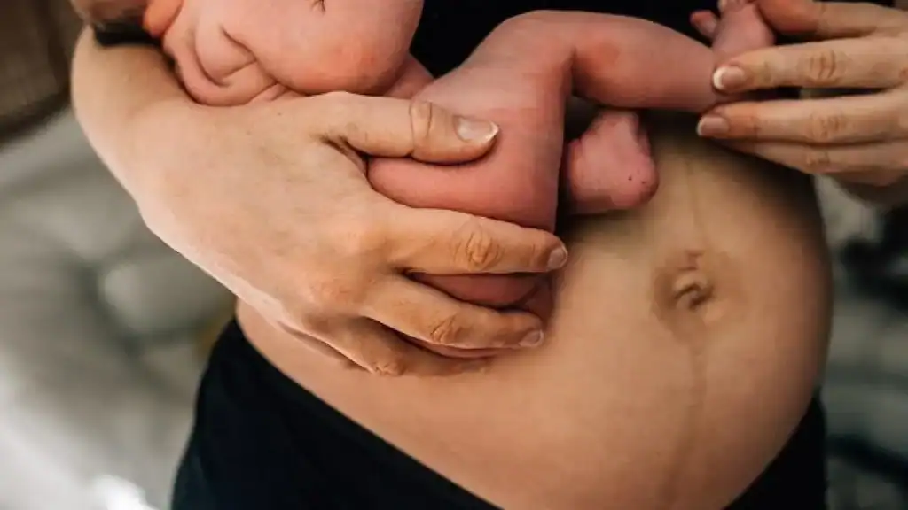 Why Is My Stomach Still Big After Pregnancy Bloxwich?